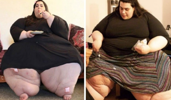 Jovem obesa de 25 anos perde mais de 180kg, fica lindíssima e fotos impressionam