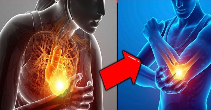6 sinais que o seu corpo mostra de infarto um mês antes e você nem imaginava