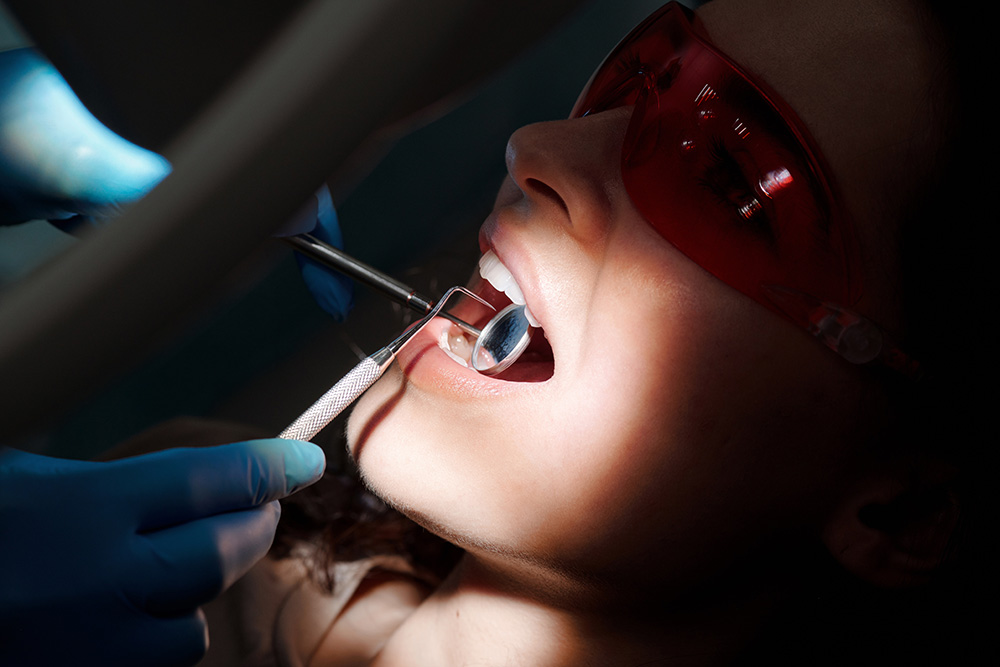 Quanto custa lentes de contato dental: Principais fatores a considerar